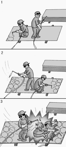 野蠻拽帶 燒傷工友