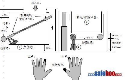 HBS鋼絲繩傷害事故