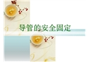 導(dǎo)管安全固定